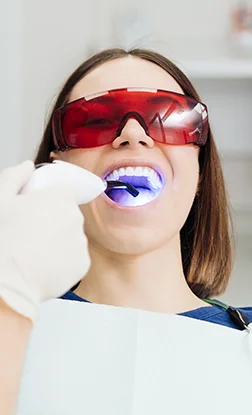 Estética Dental